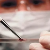 Правительство утвердило правила ведения регистров ВИЧ-инфицированных и больных туберкулёзом