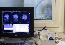 На гранты по внедрению ИИ-решений в здравоохранении в Москве выделено 147 млн руб